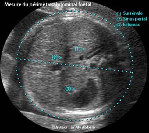 Premi re chographie De Grossesse L chographie De Datation Dossier premi-re-chographie-de-grossesse-l-chographie-de-datation-dossier